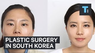 Plastic surgery in South Korea [upl. by Ajam]