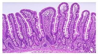 Glandular Epithelium [upl. by Safoelc]