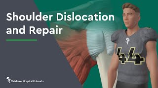 Diagnosing a shoulder dislocation [upl. by Nommad]