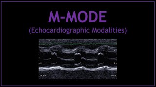 MMODE Echocardiographic Modalities [upl. by Cinomod309]