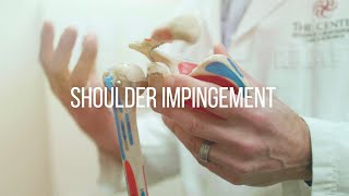 Shoulder Impingement Causes and Treatment [upl. by Toinette702]