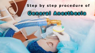 General anesthesia  step by step procedure [upl. by Xena]