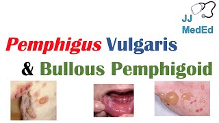 Vesiculobullous Skin Diseases  Pemphigus Vulgaris vs Bullous Pemphigoid [upl. by Chevy]