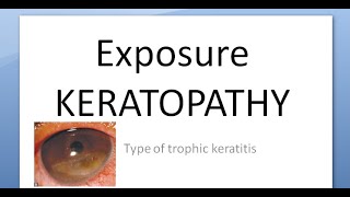 Ophthalmology 124 a Exposure KERATOPATHY Keratitis Causes Corneal Dry [upl. by Georgy335]