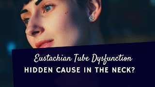 Eustachian Tube Dysfunction  Hidden Cause in the Neck [upl. by Ociral148]