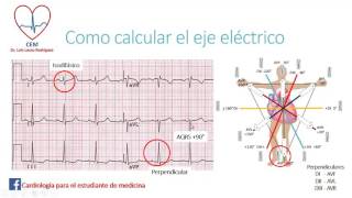 Como calcular el eje eléctrico del QRS [upl. by Nnylorac421]