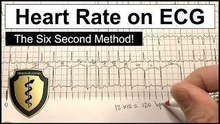 ECG Heart Rate Calculation  The Six Second Method [upl. by Radman]