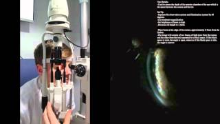 Slit Lamp Van Hericks [upl. by Ballman]