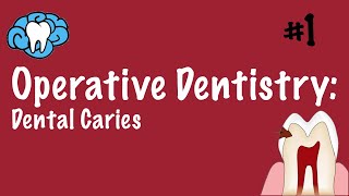 Operative Dentistry  Dental Caries  INBDE ADAT [upl. by Zebapda829]