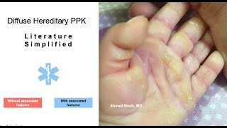 A Clinical approach to Palmoplantar Keratoderma [upl. by Lessirg]