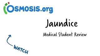 Jaundice  Clinical Presentation [upl. by Nyleuqaj]