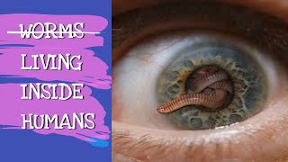 WORMS LIVING INSIDE HUMANS  EXPLAINED [upl. by Anada]