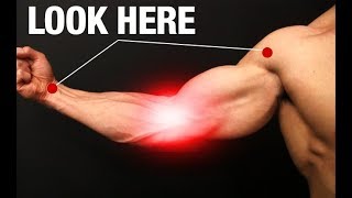 How to Fix Elbow Pain ONE SIMPLE EXERCISE [upl. by Hermosa]