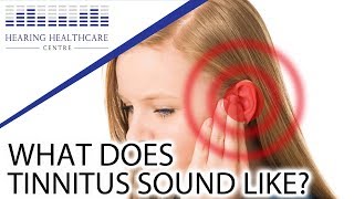 What Does Tinnitus Sound Like [upl. by Wayolle901]