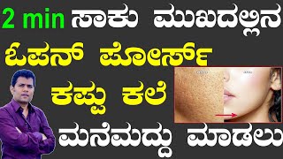 3 Moths and All Open Pores Will Disappear from Your Skin Forever  Open Pores Treatment in Kannada [upl. by Ahdar]