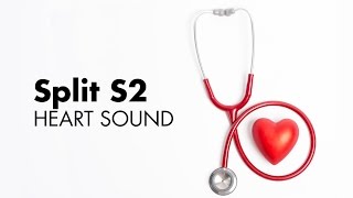 Fixed Split S2  Heart Sounds  MEDZCOOL [upl. by Darian465]