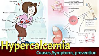 Hypercalcemia  കാൽസ്യത്തിൻറെ അളവ് കൂടാതെ തടയാം Causes Symptoms Prevention  Dr Medicosis [upl. by Tove]