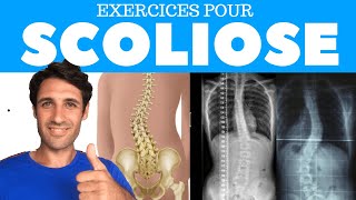 SCOLIOSE  Comment la Soulager Exercices Correctifs [upl. by Einaej]