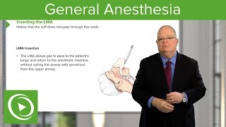 General Anesthesia – Anesthesiology  Lecturio [upl. by Asabi]