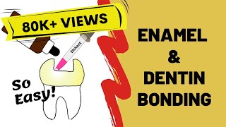 Enamel and Dentin Bonding Simplified [upl. by Llebanna168]