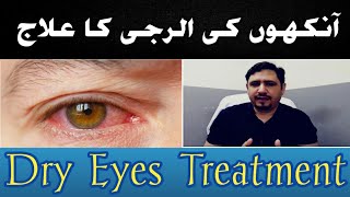 Eye Allergy Treatment urduhindi  Dry eyes Treatment  Eye Allergy Drops  Allergic conjunctivitis [upl. by Sayre]