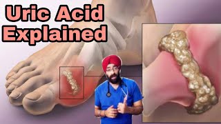 Uric Acid Problem Explained  Natural Cure amp Diet  DrEducation Hindi [upl. by Yentuoc117]