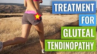 Treatment for Gluteal Tendinopathy [upl. by Rachaba]