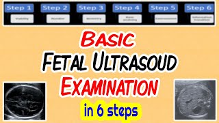 Basic Fetal Ultrasound Examination [upl. by Notffilc]