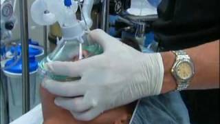 NT About Anesthesia Ch 5  General Anesthesia [upl. by Kcered]