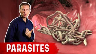 The Best Herbs for Parasites [upl. by Ainessej]