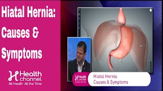 Hiatal Hernia Causes amp Symptoms [upl. by Kenlay]