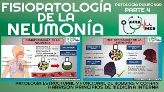 NEUMONÍA ADQUIRIDA EN LA COMUNIDAD FISIOPATOLOGÍA PARTE 1 GuiaMed [upl. by Kellene]