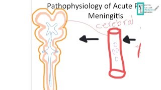 Meningitis Part 1 [upl. by Vorfeld]