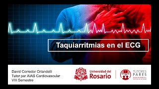 Lectura de Electrocardiograma 4 Taquiarritmias supraventriculares [upl. by Teevens219]