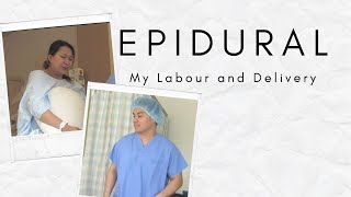 My Epidural and Delivery [upl. by Sinegra]