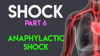 Anaphylactic Shock  Shock Part 6 [upl. by Nnylf]