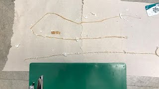 Man Pulls 5FootLong Tapeworm Out of His Gut [upl. by Winston482]