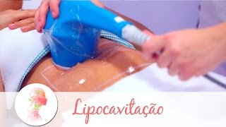 Lipocavitação tratamento estético reduz gordura localizada [upl. by Rossie877]