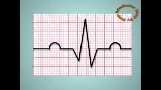 Understanding ECGs  EKG [upl. by Lancelot247]