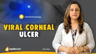 Viral Corneal Ulcer  Ophthalmology Online Lecture  Medical Student  VLearning [upl. by Dennett]