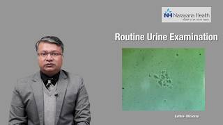 Foamy Urine Diagnosis amp Treatment  Dr Vikas Jain [upl. by Sedecrem]