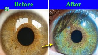 How To Lighten Eye Colour With Honey [upl. by Armin719]