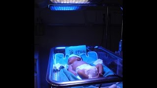 Neonatal Jaundice [upl. by Acsicnarf785]