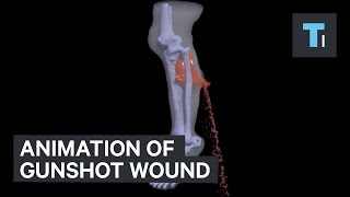 Animation of gunshot wound [upl. by Etterb]