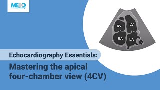 Echocardiography Essentials Mastering the apical fourchamber view 4CV [upl. by Layol]