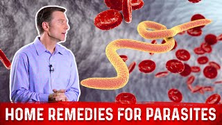 Best Home Remedies for Parasites – Dr Berg [upl. by Jutta]