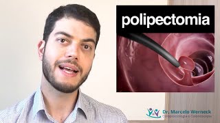 Como é a retirada de pólipos intestinais [upl. by Bergman69]