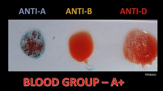 Blood group identification activity [upl. by Adniled441]