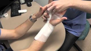 Ulnar Gutter Splint Howto [upl. by Adnohsed]