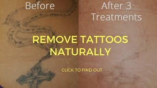 How To Remove Tattoos Naturally [upl. by Nedac]